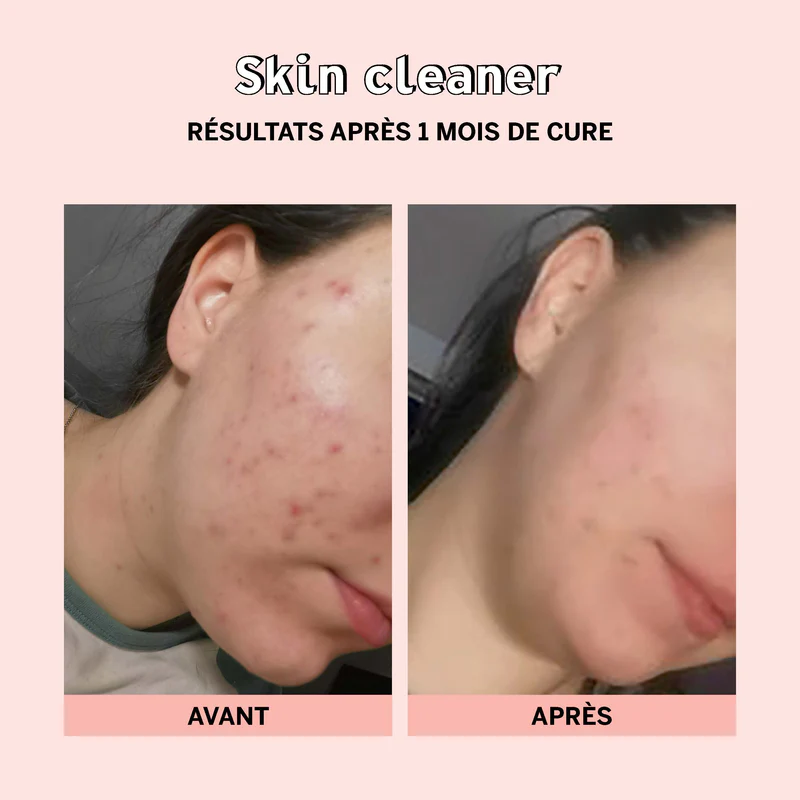 skin2